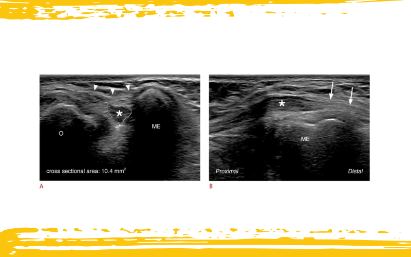 5. Diagnostico diferencial parte 1 ecografia tempo formacion.png